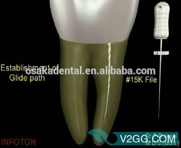 OSAKA DENTAL Precio barato K Files handuse de buena calidad File de endodoncia / instrumento quirúrgico dental con CE