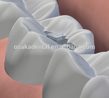 Equipo dental Amalgamator F101 digital / con aprobación CE