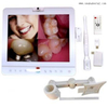 Sistema de cámara intraoral inalámbrico de monitor dental blanco de 15 pulgadas