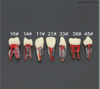 Modelo de dientes de práctica para uso de estudiantes de dentista