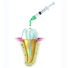 Sistema de irrigación endodoncia de presión negativa dental
