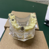 Modelos de implantes Denta con caries OSA-2008A